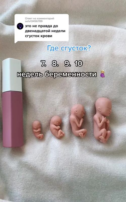 Эмбрион уже человек