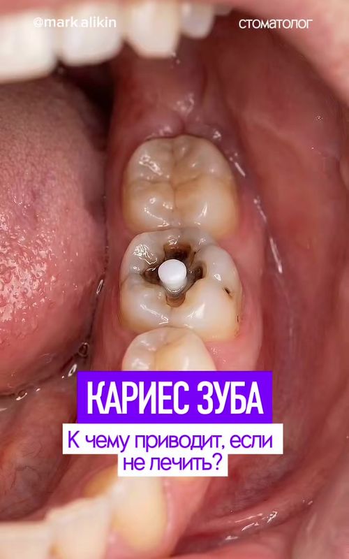 Марк Аликин
